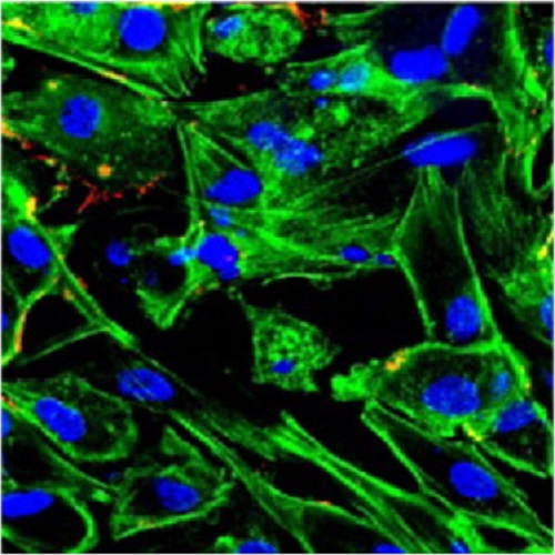 Fig.1 taken from Sampaio et al, 2011.