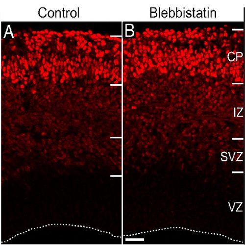 Fig.1 taken from Schenk et al, 2009.