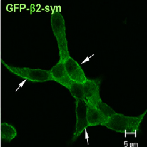 Fig.1 taken from Schubert et al, 2010.