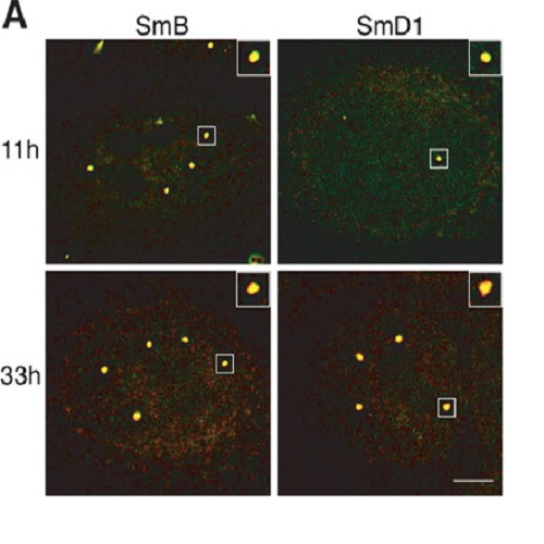 Fig.1 Taken from Stanek et al, 2008.