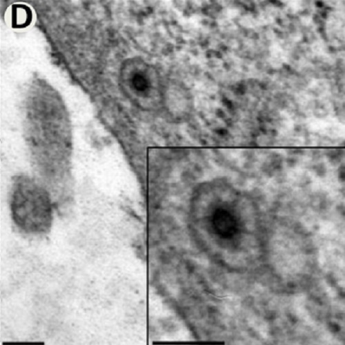 Fig.1 taken from Stirnnangel et al, 2012.