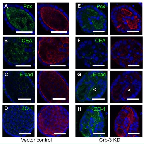 Fig. 1 taken from Torkko et al, 2008