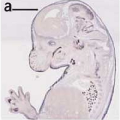 Fig.1 taken from Walter et al, 2010.