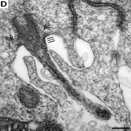 Fig.1 taken from Wilsch-Braeuninger et al, 2012.