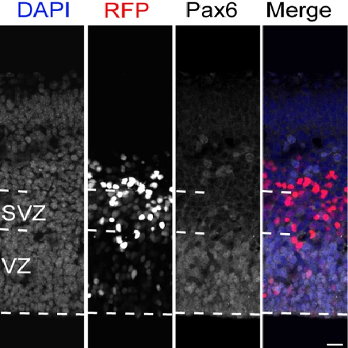 Fig.2 taken from Wong et al, 2015