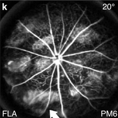 fig. 4 taken from Zacchigna et al, 2009.