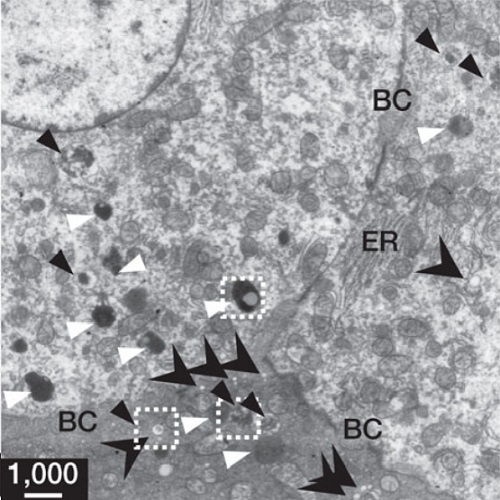 Fig.4 taken from Zeigerer et al, 2012.