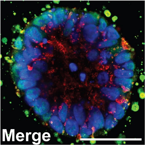 Fig.1 taken from Zhu et al, 2013.